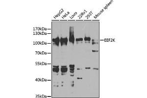 Western blot analysis of extracts of various cell lines, using EEF2K antibody (ABIN6130354, ABIN6139955, ABIN6139956 and ABIN7101771) at 1:1000 dilution. (EEF2K antibody  (AA 406-725))