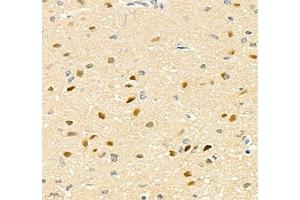 Immunohistochemistry of paraffin embedded rat brain using TCEAL3 (ABIN7075951) at dilution of 1:700 (400x lens) (TCEAL3 antibody)