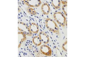 Immunohistochemical analysis of paraffin-embedded H. (PGK1 antibody  (AA 117-145))