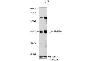 Western blot analysis of extracts of NIH/3T3 cells, using Phospho-IRF3-S396 antibody (ABIN6135244, ABIN6136112, ABIN6136113 and ABIN6225633) at 1:1000 dilution. (IRF3 antibody  (pSer396))