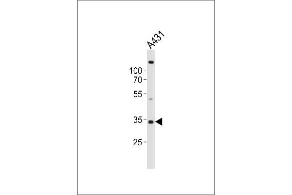 UTF1 anticorps  (AA 164-199)