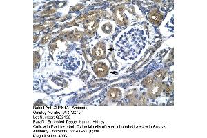 Human kidney (IKZF1 antibody  (Middle Region))