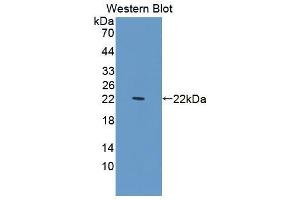Western blot analysis of recombinant Human PDCD6.