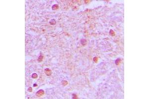 Immunohistochemical analysis of TLE4 staining in human brain formalin fixed paraffin embedded tissue section. (TLE4 antibody  (Center))