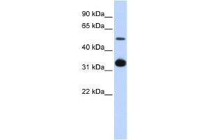 GDF2 antibody used at 1 ug/ml to detect target protein. (GDF2 antibody  (Middle Region))