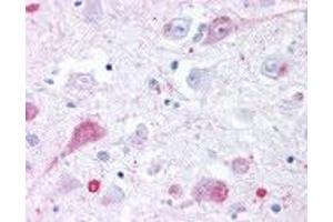 Human Brain, Thalamus (formalin-fixed, paraffin-embedded) stained with GRM2 antibody ABIN213522 at 4 ug/ml followed by biotinylated goat anti-rabbit IgG secondary antibody ABIN481713, alkaline phosphatase-streptavidin and chromogen. (GRM2 antibody  (N-Term))
