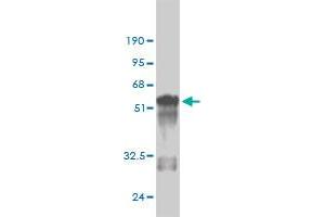 Western Blotting (WB) image for anti-Methyl-CpG Binding Domain Protein 5 (MBD5) (AA 1-229) antibody (ABIN565923)
