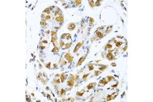 Immunohistochemistry of paraffin-embedded human stomach using PIAS3 antibody (ABIN5974247) at dilution of 1/100 (40x lens). (PIAS3 antibody)