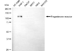 Western blotting analysis using progesterone receptor antibody (ABIN7799906). (Recombinant Progesterone Receptor antibody)