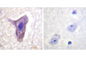 P-peptide - +Immunohistochemistry analysis of paraffin-embedded human brain tissue using CD88/C5aR (Phospho-Ser338) antibody. (C5AR1 antibody  (pSer338))