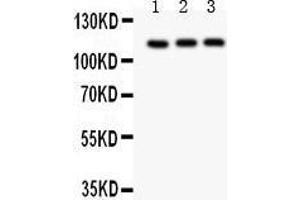 Anti- TRPC5 Picoband antibody, Western blotting All lanes: Anti TRPC5  at 0. (TRPC5 antibody  (AA 684-973))
