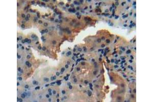 Used in DAB staining on fromalin fixed paraffin-embedded kidney tissue (N-Acetyl alpha-D-Glucosaminidase (AA 485-743) antibody)