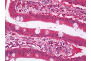 Human Small Intestine: Formalin-Fixed, Paraffin-Embedded (FFPE). (ARHGEF7 antibody  (Biotin))