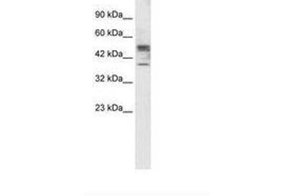 CHST4 antibody  (AA 156-205)