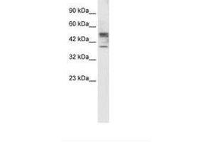 Image no. 2 for anti-Carbohydrate (N-Acetylglucosamine 6-O) Sulfotransferase 4 (CHST4) (AA 156-205) antibody (ABIN202397) (CHST4 antibody  (AA 156-205))