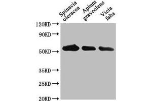 Western Blot Positive WB detected in: Spinacia oleracea leaf tissue, Apium graveolens leaf tissue, Vicia faba leaf tissue All lanes: PEX14 antibody at 1:1000 Secondary Goat polyclonal to rabbit IgG at 1/50000 dilution Predicted band size: 56 kDa Observed band size: 56 kDa (PEX14 antibody  (AA 288-507))