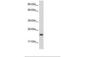 Image no. 2 for anti-Achaete-Scute Complex Homolog 1 (Drosophila) (ASCL1) (AA 48-97) antibody (ABIN202101) (ASCL1 antibody  (AA 48-97))