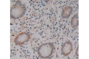#VALUE! (GYPE antibody  (AA 20-70))