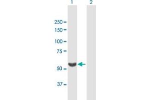 Western Blot analysis of TBL1X expression in transfected 293T cell line by TBL1X MaxPab polyclonal antibody. (TBL1X antibody  (AA 1-526))