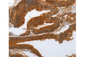 Immunohistochemistry (IHC) image for anti-Notch 3 (NOTCH3) antibody (ABIN6220071) (NOTCH3 antibody)