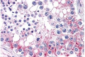 Human Testis (formalin-fixed, paraffin-embedded) stained with ABCB9 antibody ABIN351468 at 3. (ABCB9 antibody  (AA 757-769))