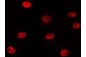 ABIN6275197 staining 293T by IF/ICC. (SIX Homeobox 1 antibody  (Internal Region))