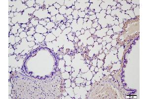 Immunohistochemistry (Paraffin-embedded Sections) (IHC (p)) image for anti-Matrix Metalloproteinase 2 (MMP2) (AA 31-109) antibody (ABIN668286)