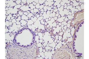 Paraformaldehyde-fixed, paraffin embedded Mouse lung, Antigen retrieval by boiling in sodium citrate buffer (pH6. (MMP2 antibody  (AA 31-109))