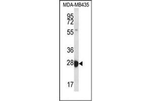 Western blot analysis of RAB27B Antibody  in MDA-MB435 cell line lysates (35ug/lane). (RAB27B antibody  (Middle Region))