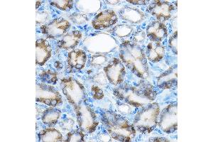 Immunohistochemistry of paraffin-embedded rat kidney using MRPL13 Rabbit pAb  at dilution of 1:100 (40x lens). (MRPL13 antibody  (AA 1-179))