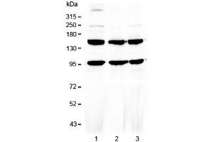 Western blot testing of human 1) HeLa, 2) MCF7 and 3) HepG2 cell lysate with VEGFR3 antibody at 0. (FLT4 antibody)