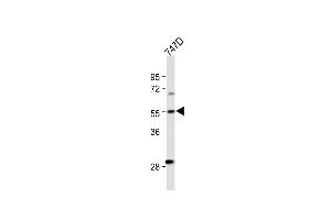 All lanes : Anti-CYP27B1 Antibody (C-term) at 1:500 dilution Lane 1: T47D whole cell lysate Lysates/proteins at 20 μg per lane. (CYP27B1 antibody  (C-Term))