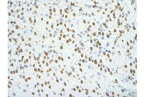 Immunohistochemistry (IHC) image for anti-Splicing Factor Proline/glutamine-Ric (SFPQ) (N-Term) antibody (ABIN2778925)