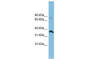 SLC6A15 antibody used at 1 ug/ml to detect target protein. (SLC6A15 antibody)