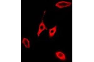 Immunofluorescent analysis of KLK10 staining in A549 cells. (Kallikrein 10 antibody)