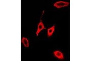 Immunofluorescent analysis of KLK10 staining in A549 cells. (Kallikrein 10 antibody)