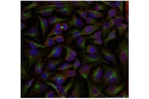 Image no. 1 for anti-Stathmin 1 (STMN1) (Ser24) antibody (ABIN197454) (Stathmin 1 antibody  (Ser24))