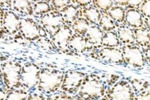 Immunohistochemistry analysis of paraffin-embedded mouse colon using mSin3A (ABIN7075609) at dilution of 1: 100 (SIN3A antibody)