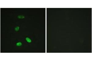 Immunofluorescence analysis of HeLa cells, using MYB (Ab-12) Antibody. (MYB antibody  (AA 1-50))