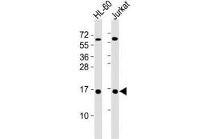 Western Blotting (WB) image for anti-Small Ubiquitin Related Modifier Protein 1 (SUMO1) antibody (ABIN3032642)