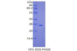SDS-PAGE (SDS) image for Ubiquitin Carboxyl-terminal Hydrolase L5 (UCHL5) (AA 66-268) protein (His tag) (ABIN2122306)