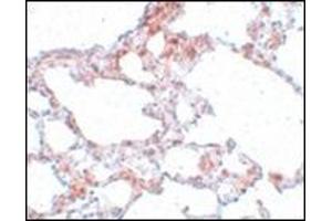 Immunohistochemistry of MRE11 in rat lung tissue with MRE11 antibody at 5 μg/ml. (Mre11 antibody  (N-Term))