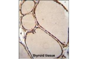 NFKBID Antibody (N-term) (ABIN655836 and ABIN2845251) immunohistochemistry analysis in formalin fixed and paraffin embedded human thyroid tissue followed by peroxidase conjugation of the secondary antibody and DAB staining. (NFKBID antibody  (N-Term))