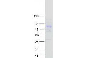 Western Blotting (WB) image for Plasminogen Activator Inhibitor 1 (SERPINE1) protein (Myc-DYKDDDDK Tag) (ABIN2731824)