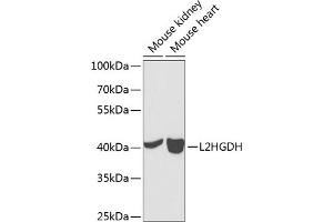 Western blot analysis of extracts of various cell lines, using L2HGDH antibody (ABIN6132151, ABIN6143055, ABIN6143056 and ABIN6224014) at 1:1000 dilution. (L2HGDH antibody  (AA 1-220))