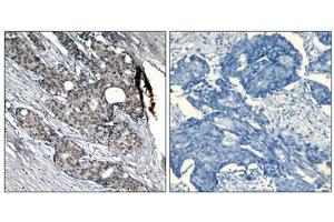 Immunohistochemistry (IHC) image for anti-Tumor Protein P53 (TP53) (pSer6) antibody (ABIN7138655)