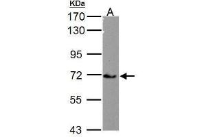 CACNB4 antibody  (C-Term)