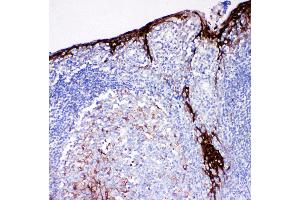Anti-Cystatin A antibody, IHC(P) IHC(P): Human Tonsil Tissue (CSTA antibody  (C-Term))