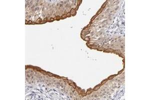 Immunohistochemical staining of human urinary bladder with C14orf135 polyclonal antibody  shows strong cytoplasmic positivity in urothelial cells at 1:20-1:50 dilution. (PCNXL4 antibody)