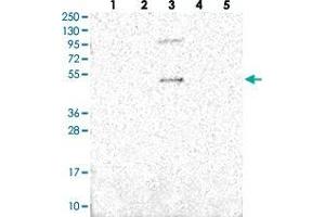 Western blot analysis of Lane 1: RT-4, Lane 2: U-251 MG, Lane 3: Human Plasma, Lane 4: Liver, Lane 5: Tonsil with SLC10A5 polyclonal antibody . (SLC10A5 antibody)